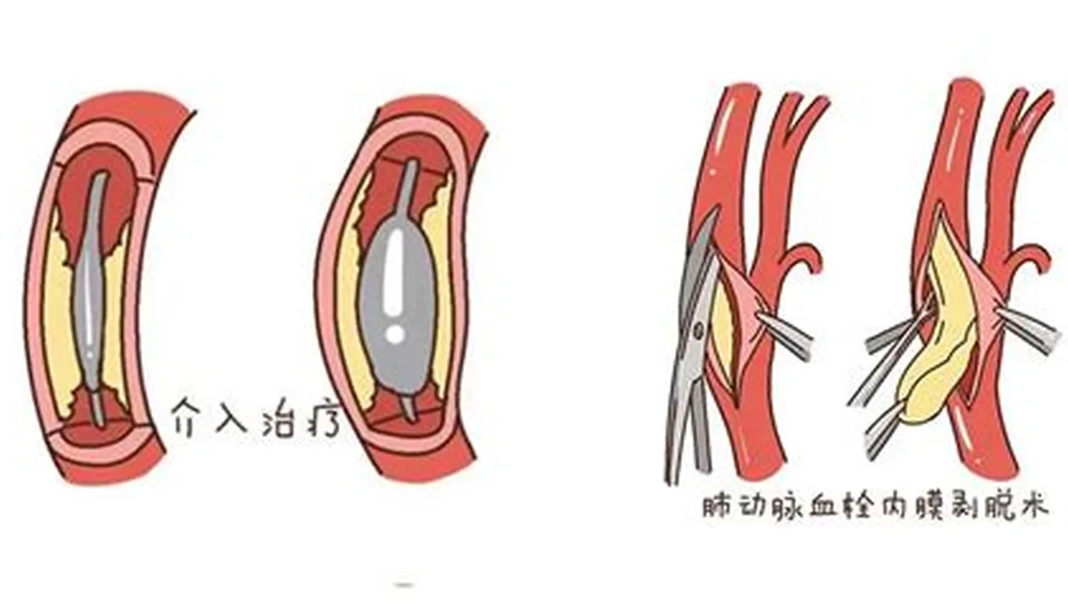 电子体重秤